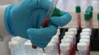 Change in direction for Northern TB rates