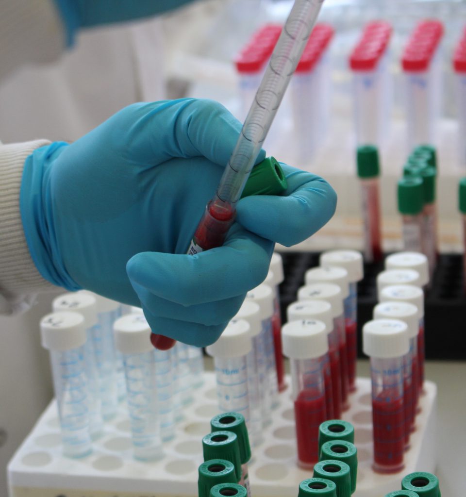 Six-hour TB test