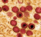Study finds Pirbright African swine fever vaccine has 100% success rate