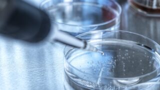 Second case of foot-and-mouth disease in Germany ruled out